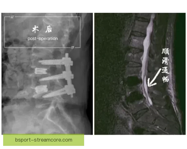 浓眉左手韧带恢复顺利获准进行轻度对抗训练全面复出稳步推进
